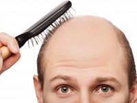Tiết lộ mẹo chữa rụng tóc ở nam giới hiệu quả nhất