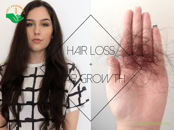 Tại sao tóc rụng nhiều bất thường