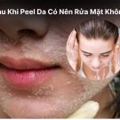 Sau Khi Peel Da Có Nên Rửa Mặt Không Hướng Dẫn Chi Tiết Và Lưu Ý