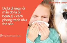 Da bị dị ứng nổi mẩn đỏ là bị bệnh gì cách phòng tránh như thế nào