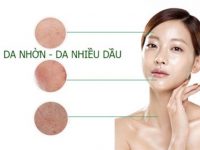 Thử ngay cách chăm sóc da dầu mùa hè chuẩn nhất