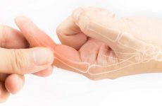 Đau khớp ngón tay là bệnh gì Cách điều trị, phòng ngừa hiệu quả tại nhà