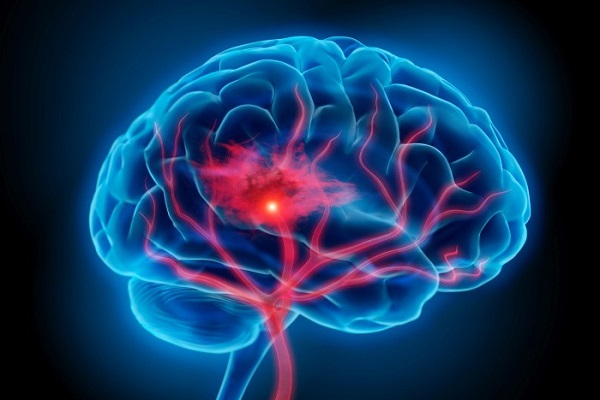 Cách trị thiếu máu não tại nhà tốt nhất đó là nên hỗ trợ bổ sung hoạt huyết dưỡng não mỗi ngày.