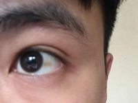 Dấu hiệu các bệnh về mắt
