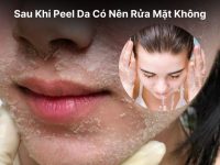 Sau Khi Peel Da Có Nên Rửa Mặt Không Hướng Dẫn Chi Tiết Và Lưu Ý