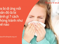 Da bị dị ứng nổi mẩn đỏ là bị bệnh gì cách phòng tránh như thế nào